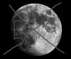 mond%201%20gross1.jpg