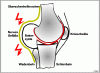 knie30.gif