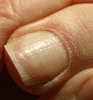 Nagelbig1.gif