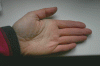 Raynaud_2554.gif