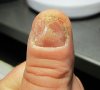 nagelpilz.24.7.11.jpg