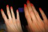 Entzündungen Finger neu.jpg