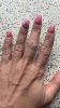 finger Entzündung.jpg