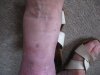 Bild5_Druckstelle_25072023.JPG Bild5_Druckstelle_25072023.JPG