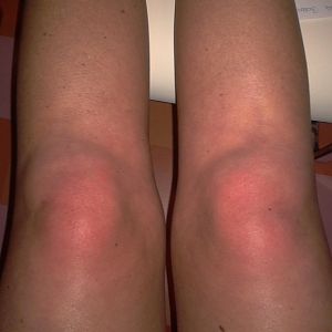 Ein paar Bilder meiner sorgen