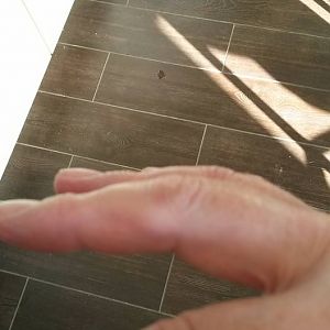 Sjörgren, Fibro, PSA
